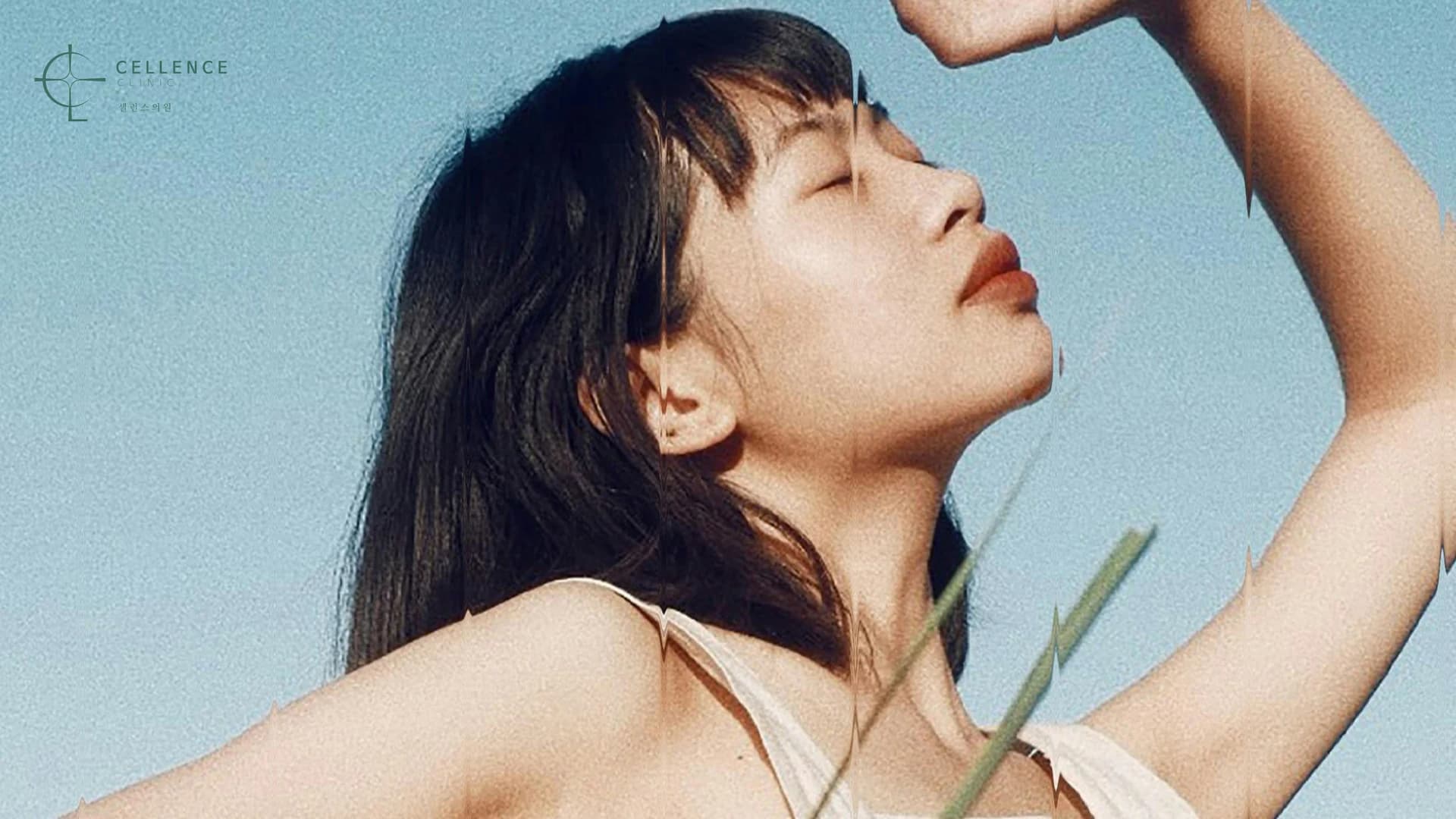 다한증 보톡스(땀 주사) 썸네일